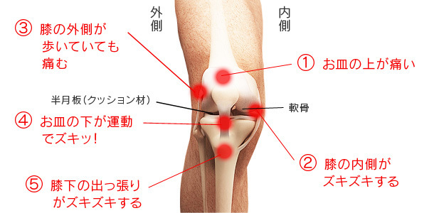 場所別の膝の痛みの画像