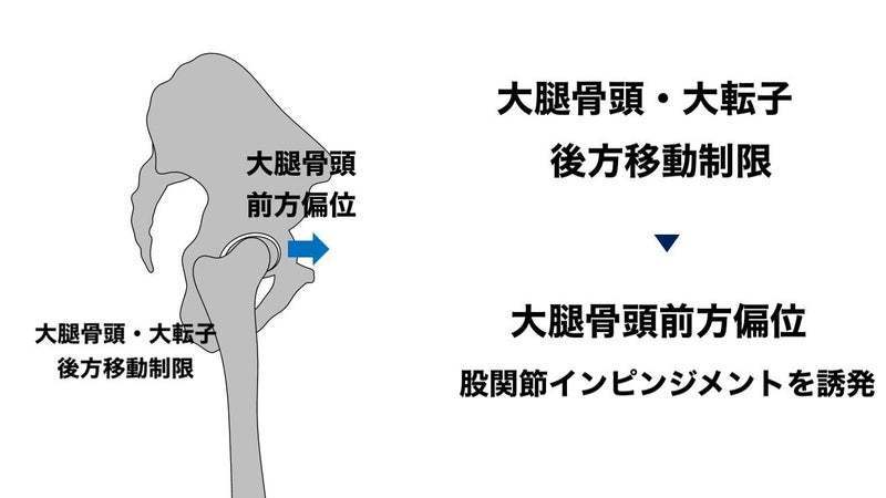 股関節屈曲時の骨頭の動きの画像