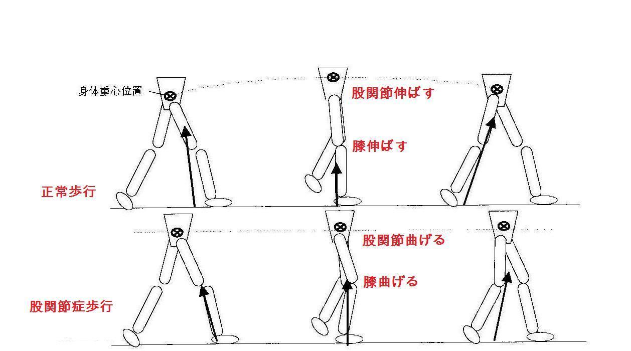 症状出るまでのフローチャート