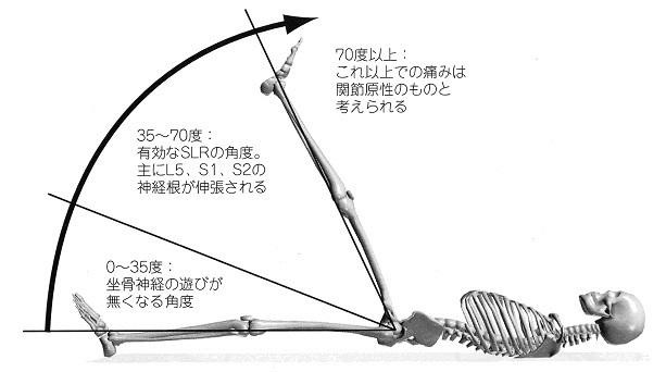 SLR検査法の画像