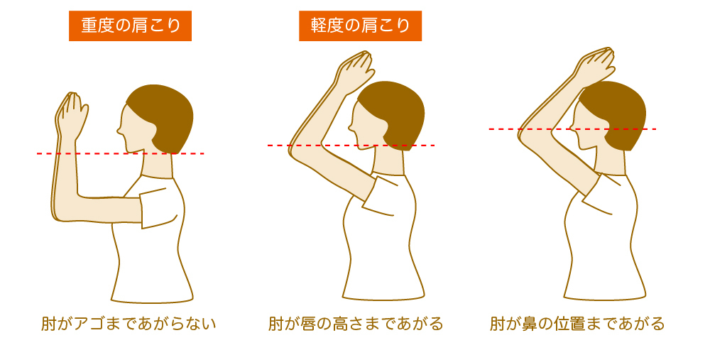 肩こりの状態をチェックする方法の画像