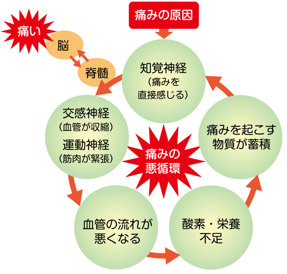 痛みができるまでのメカニズムの画像