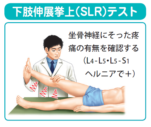 ＳLRテストのやり方の画像