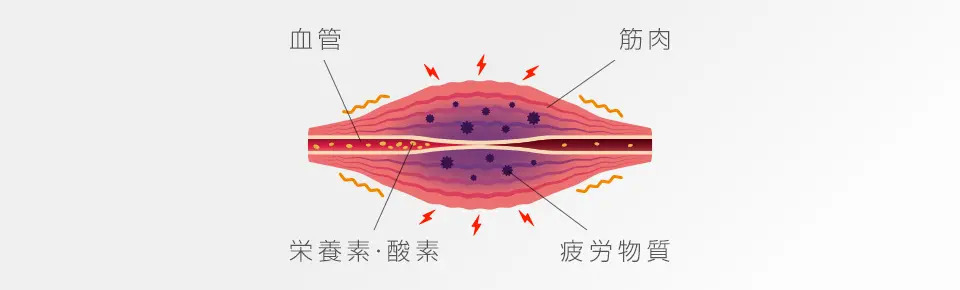 筋が硬くなった時の血管絞扼の画像