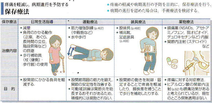 変形性股関節症における対応の解説