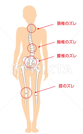 歪みの画像