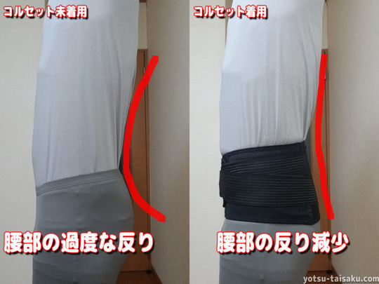 コルセットは必要なのか 八戸市の腰痛専門 たか接骨院 坐骨神経痛 脊柱管狭窄症